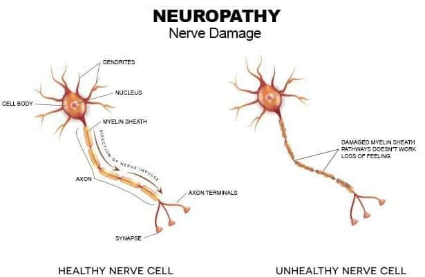 Nerve Fresh Plant-Based Nerve Formula